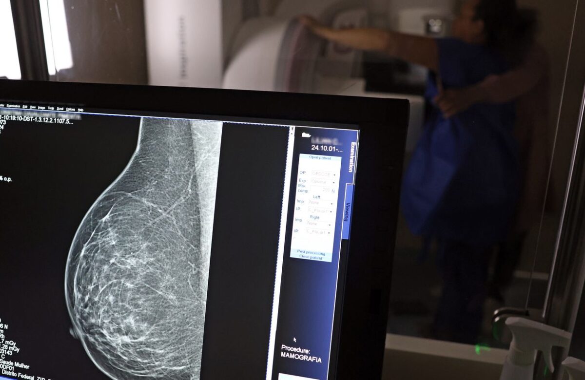 Falta de acesso a mamógrafos limita prevenção do câncer de mama