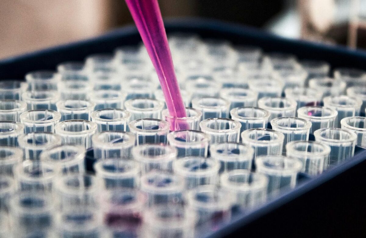 Pesquisas brasileiras avançam no diagnóstico de Alzheimer