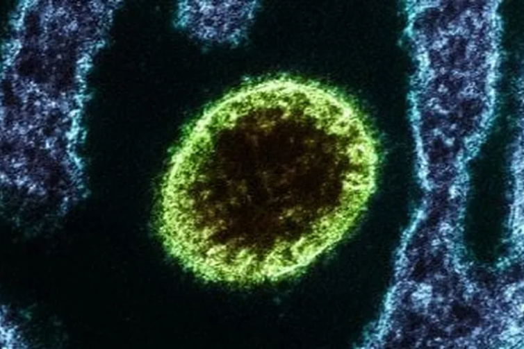 Vírus Nipah: tudo o que se sabe até agora sobre o microrganismo letal