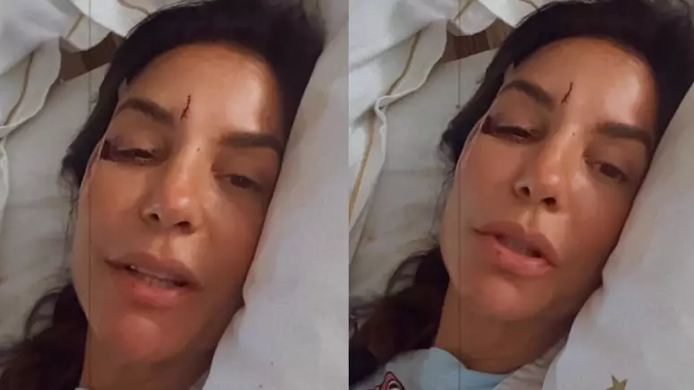 Ivete Sangalo é hospitalizada em Salvador após acidente dentro de casa