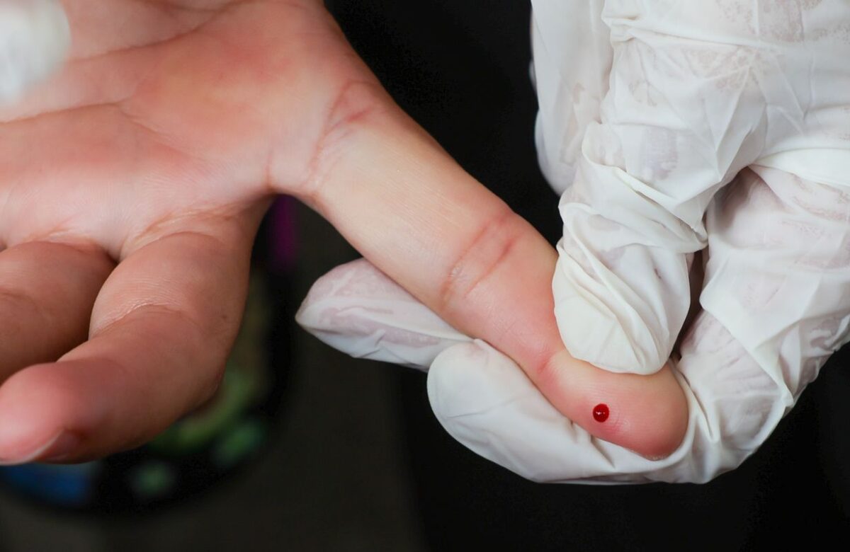 SUS passa a oferecer teste rápido de dengue