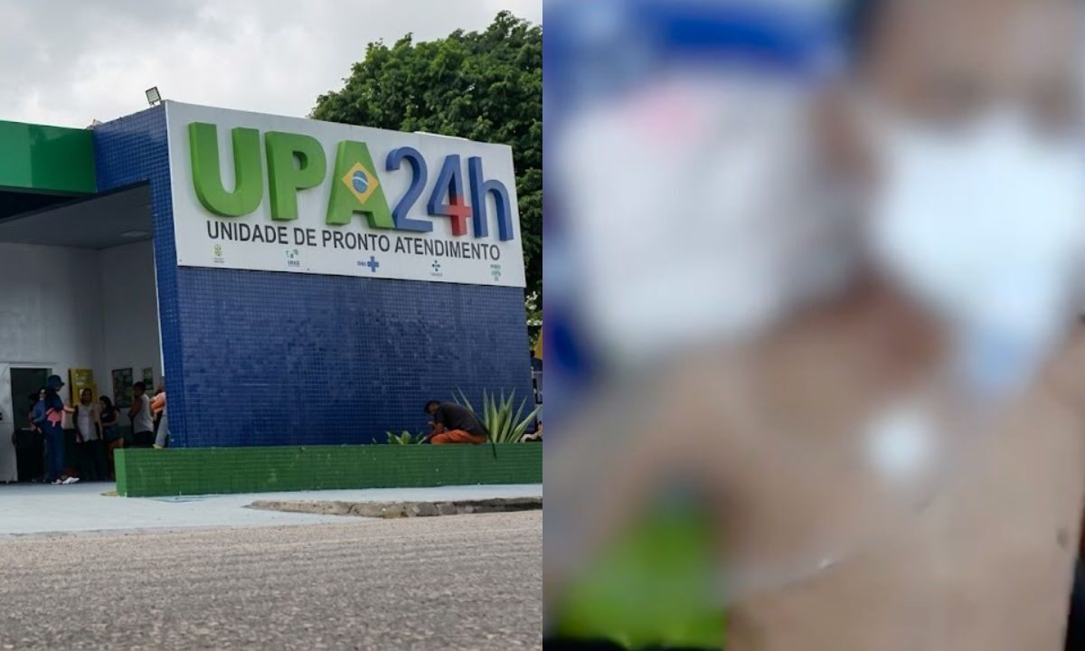 Jovem de 18 anos morre após dias internado com infecção dentária em UPA de Ananindeua enquanto aguardava transferência